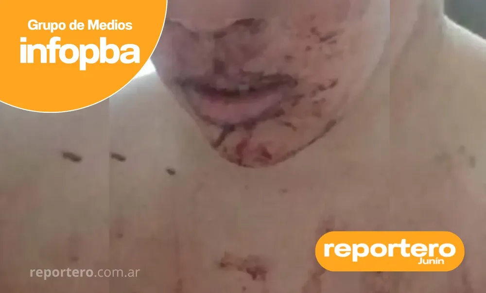 IMG GERMAN REPORTERO(439)